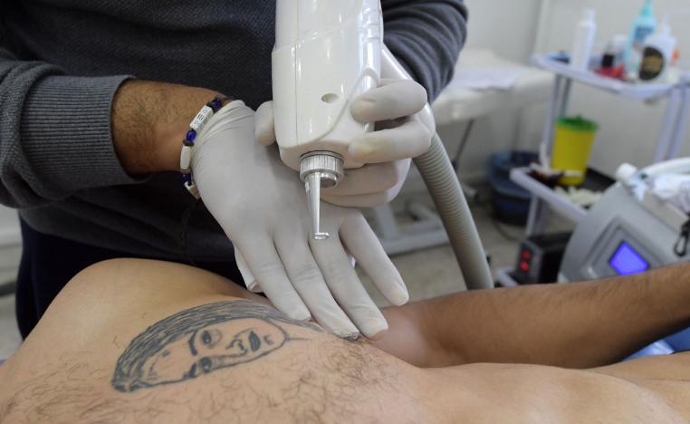 Tunisian tattoo artist Fawez Zahmoul removes a tattoo from his client in his school on November 8, 2018 in Tunis.