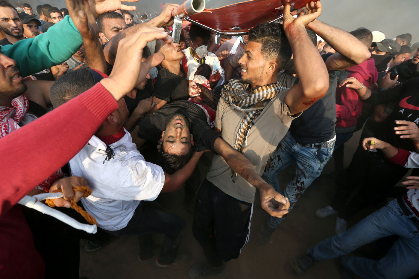 A wounded Palestinian is evacuated during a protest calling for lifting the Israeli blockade on Gaza.