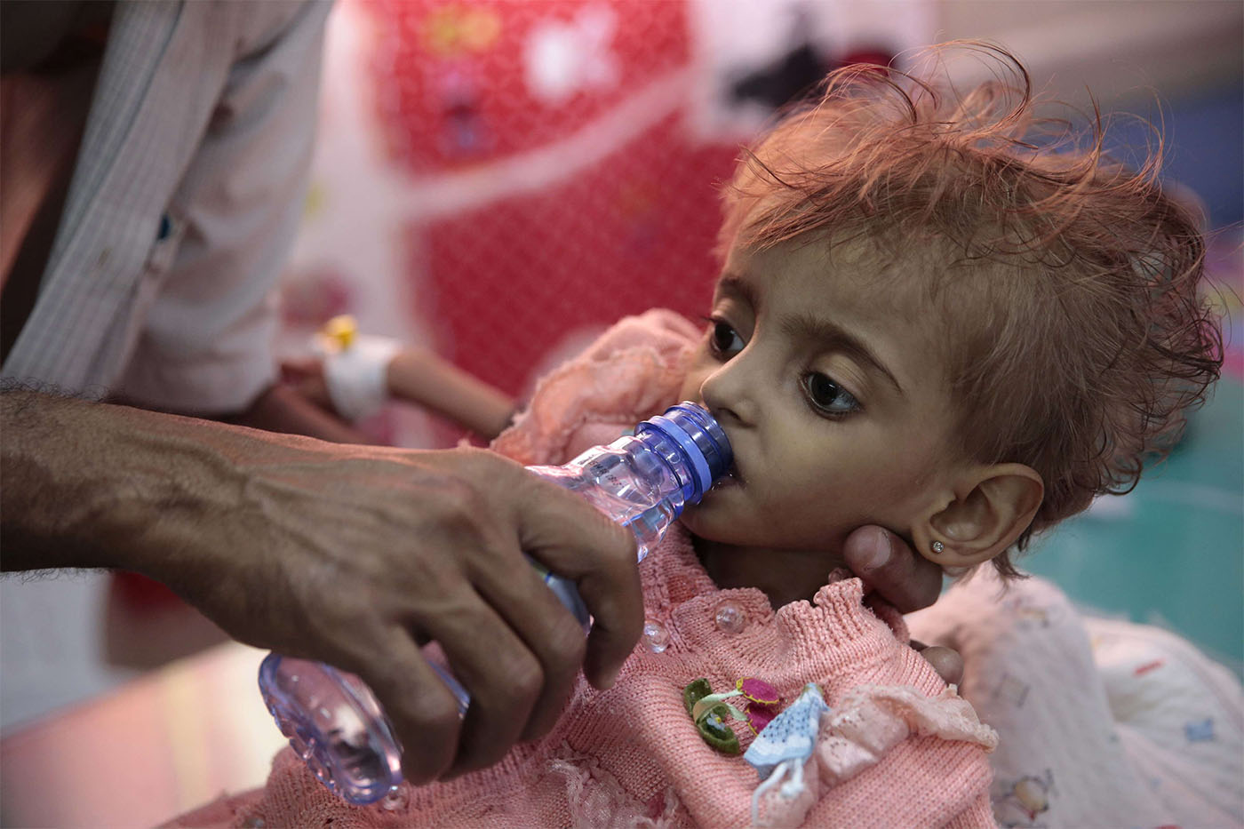 A father gives water to his malnourished daughter at a feeding center in a hospital in Hodeidah