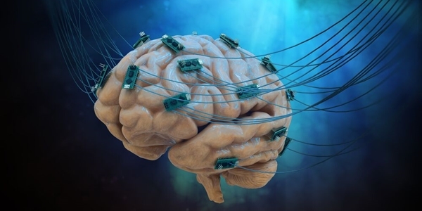 التحفيز الكهربائي للدماغ