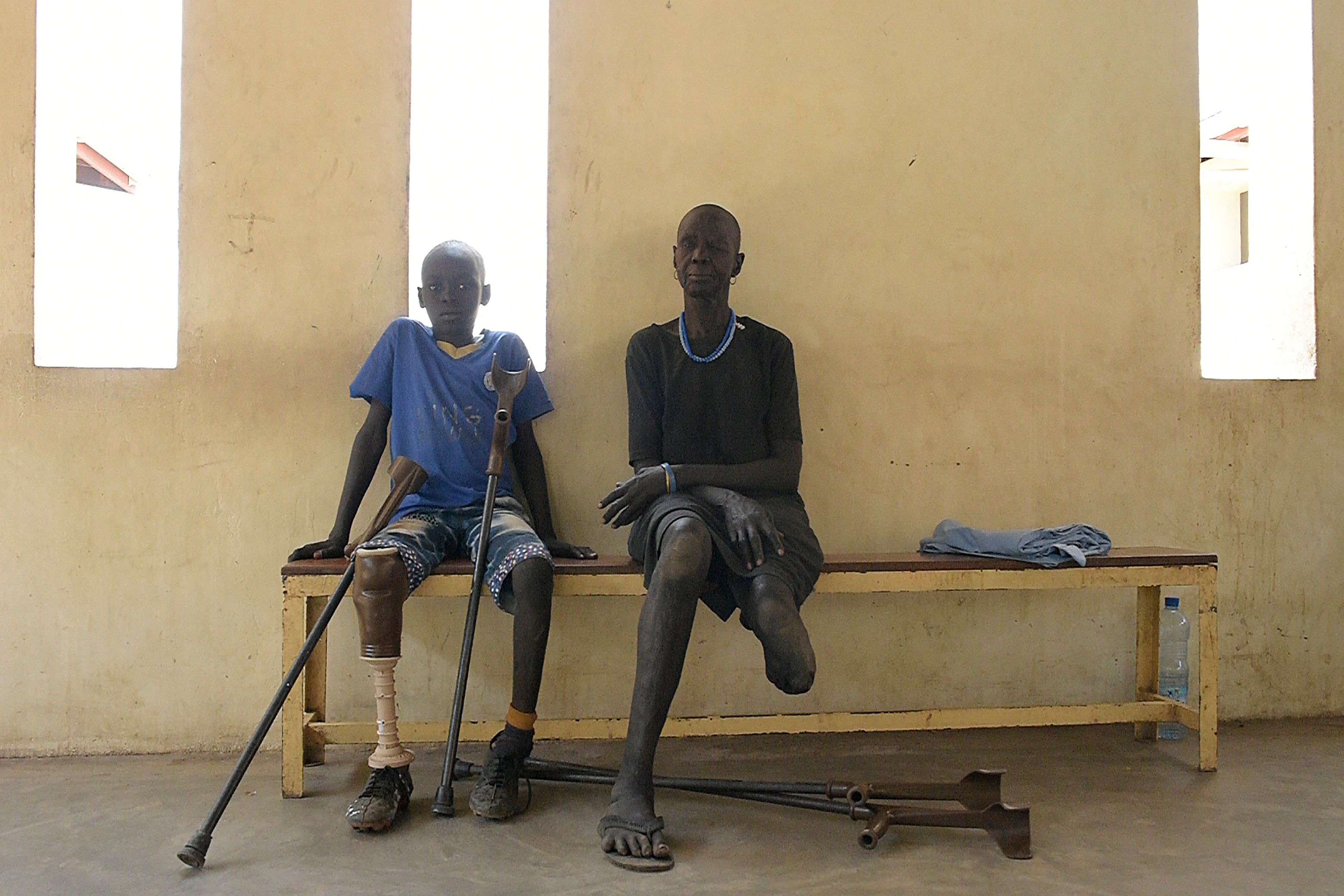South Sudan's five-year-long civil war has left possibly tens of thousands of people without limbs