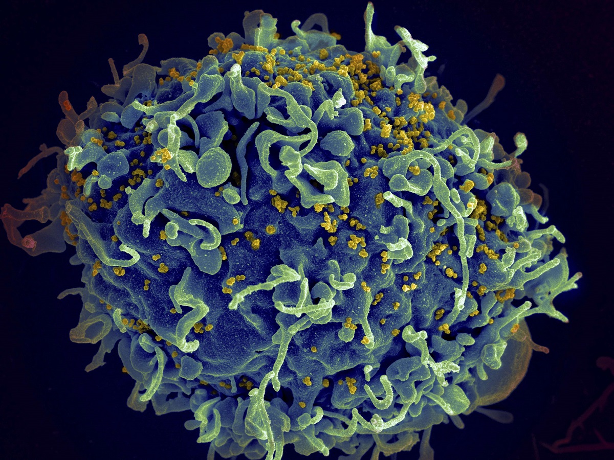 صورة مجهرية تظهر تعرض خلية بشرية لهجوم فيروسي