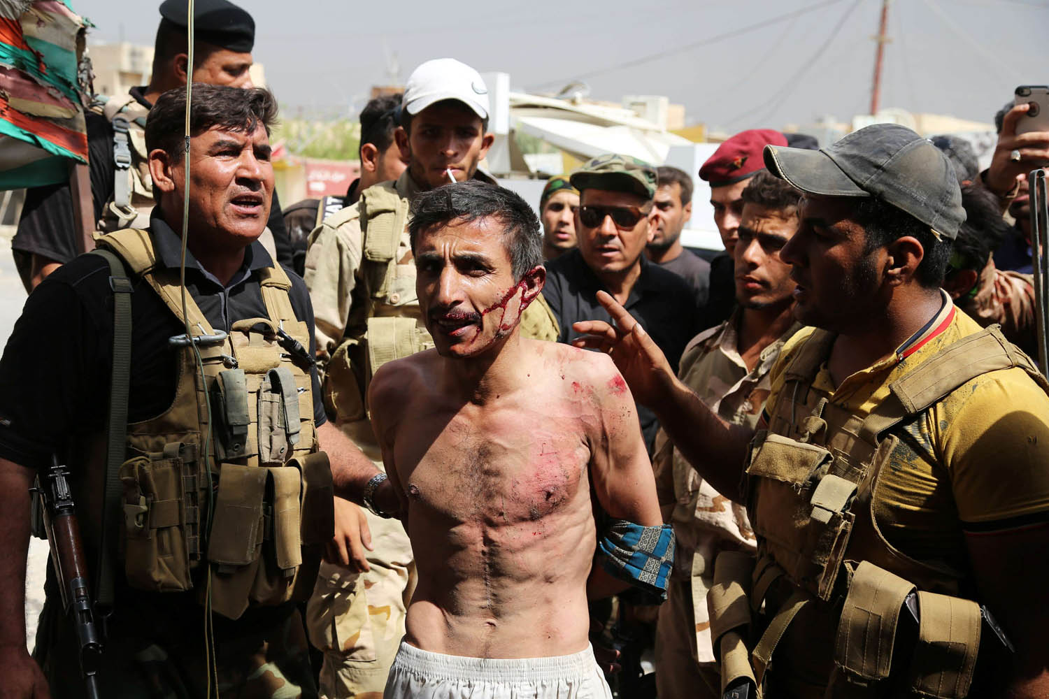 قوات عراقية تعتقل مقاتلا مصابا من داعش