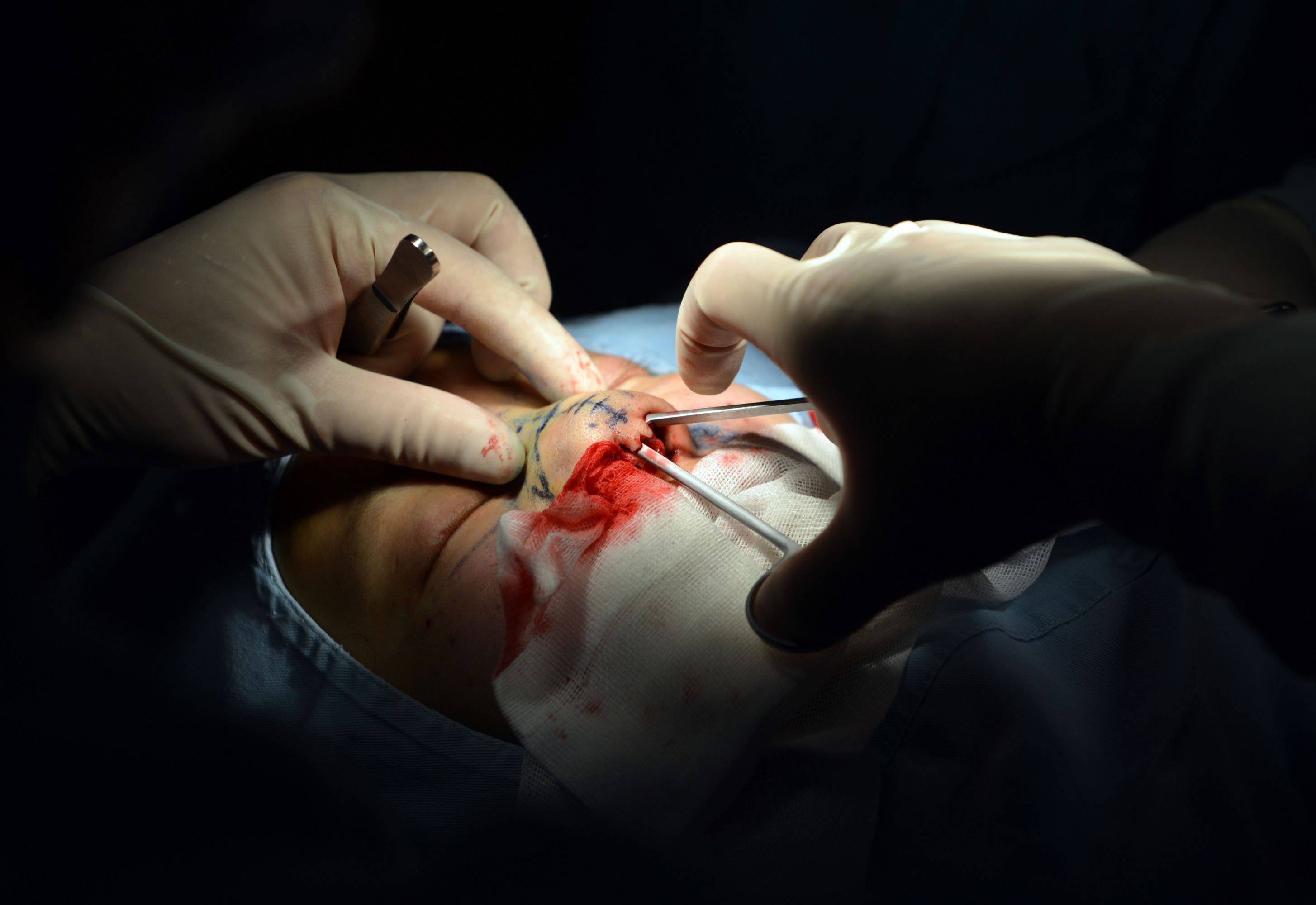 عمليات التجميل