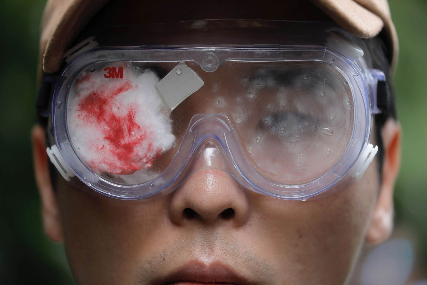 متظاهر يضع ضمادة على عينه تضامنا مع متظاهرة فقدت عينها في احتجاجات هونغ كونغ