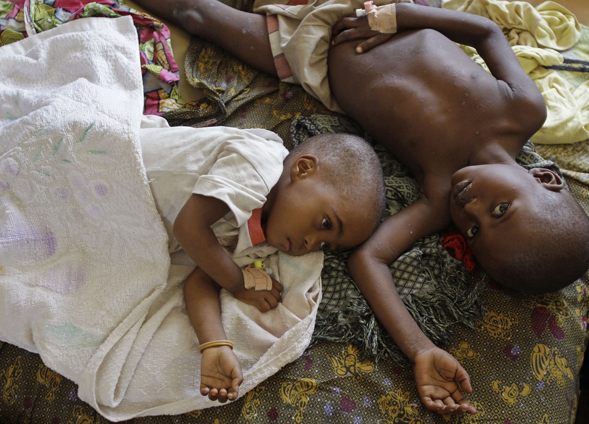طفلان من الكونغو مصابان بمرض الملاريا