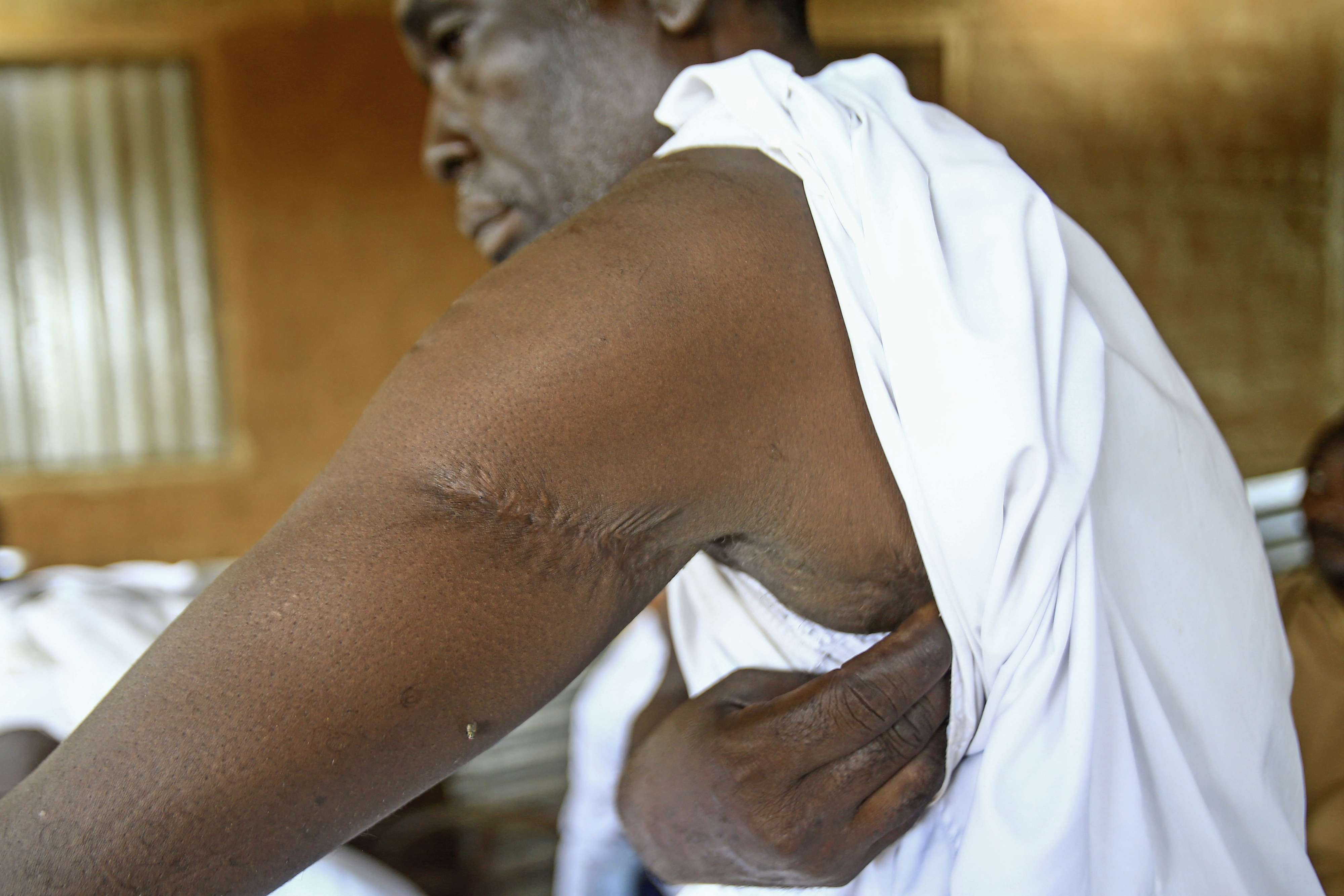ضحايا الحروب في السودان