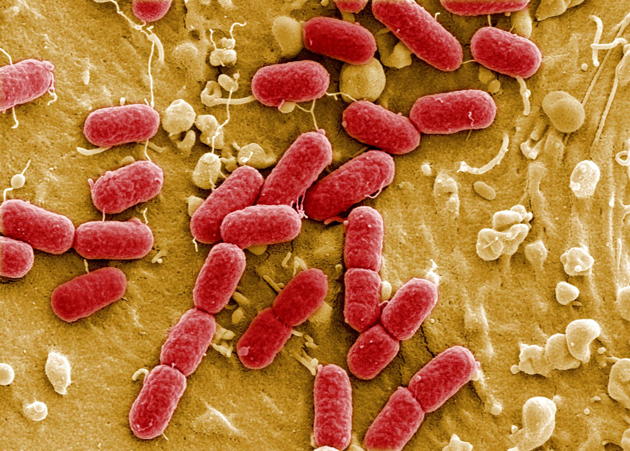 البكتيريا الإشريكية القولونية 