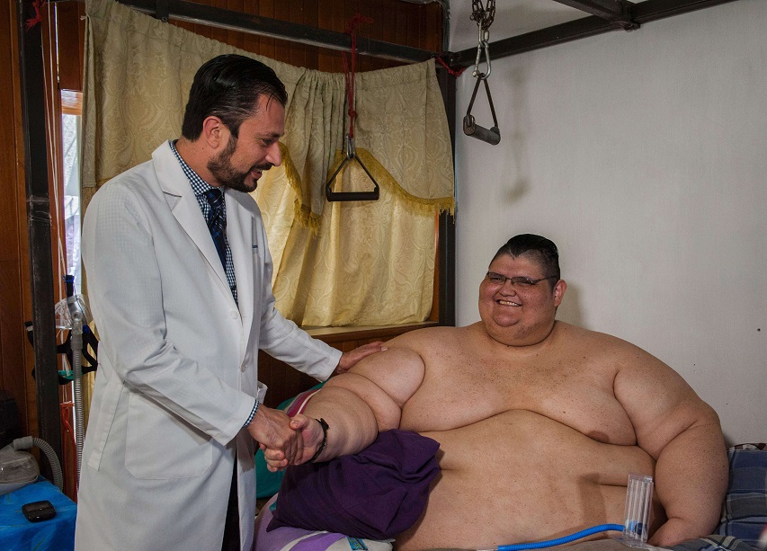 السمنة 