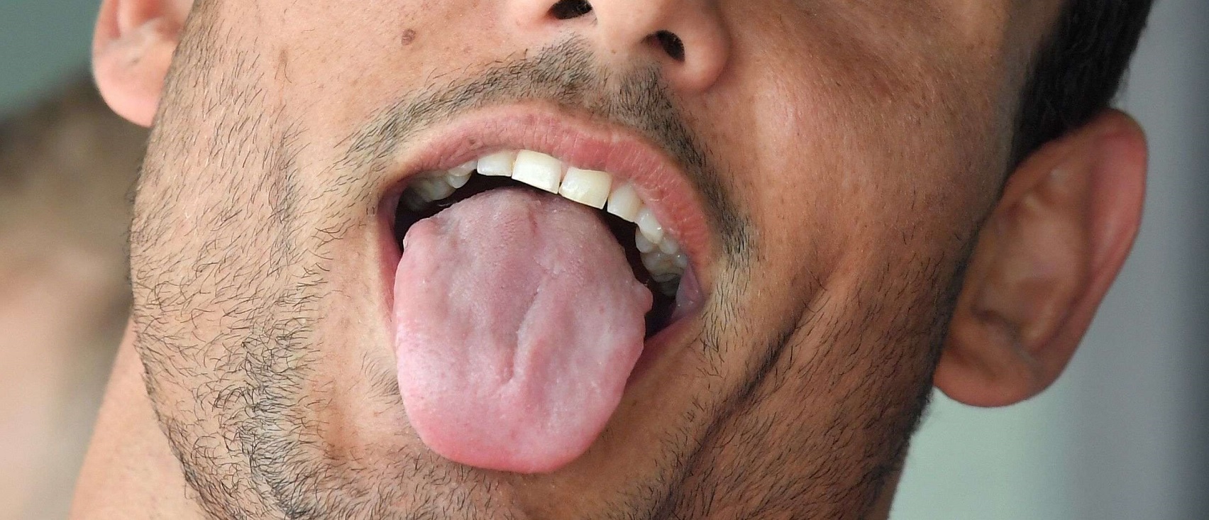 دهون اللسان
