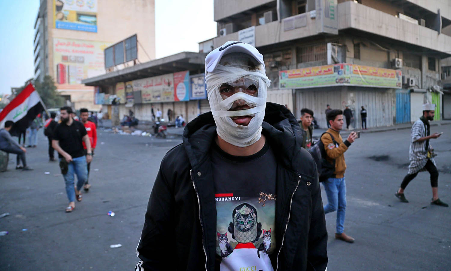 محتج عراقي تعرض لحرق في وجهه في مواجهات مع قوات الأمن