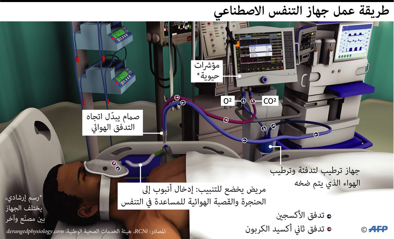 جهاز تنفس اصطناعي
