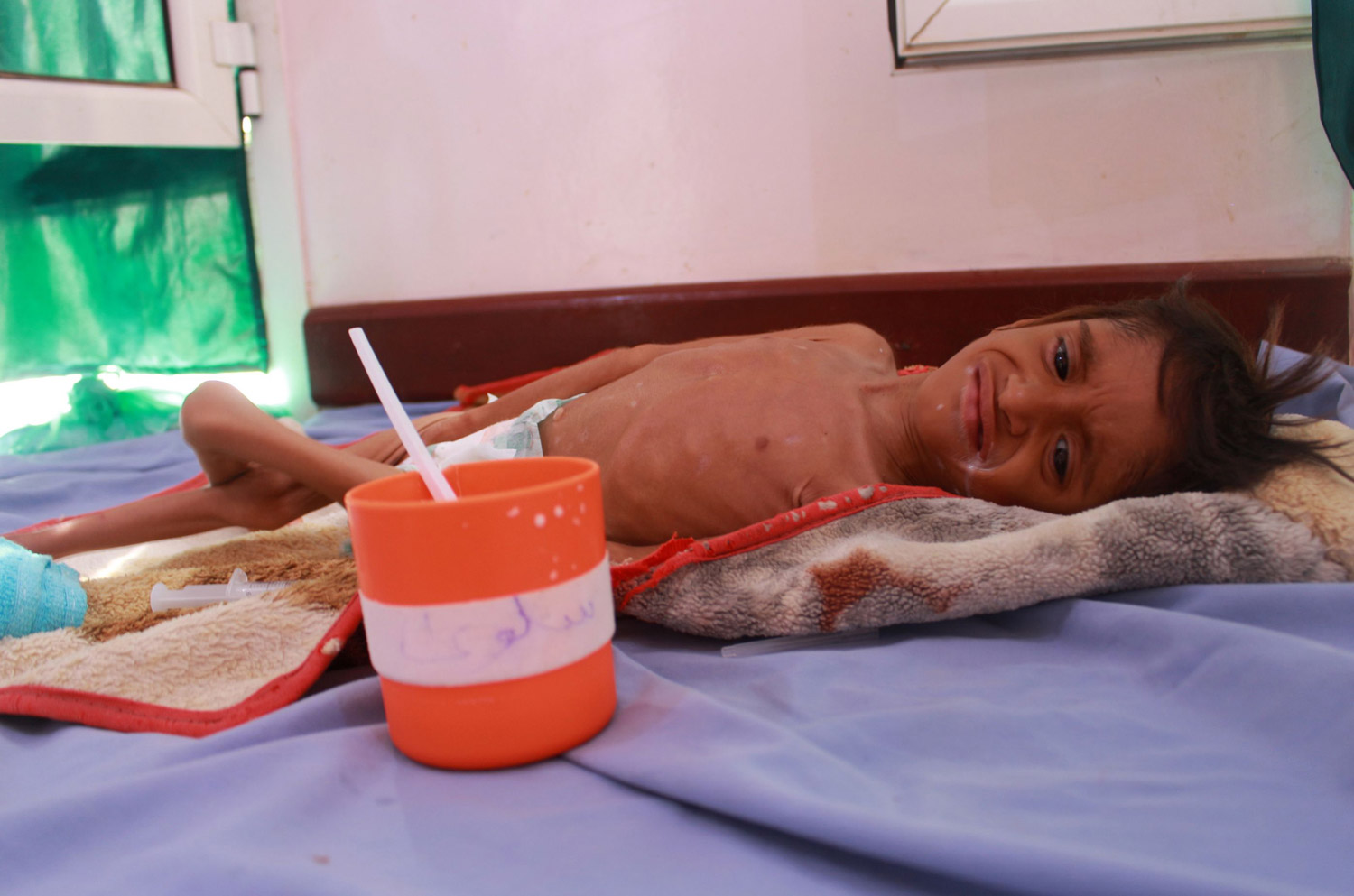الجوع وكورونا يتكتلان على الأطفال بينما يسرق الحوثيون قوتهم 