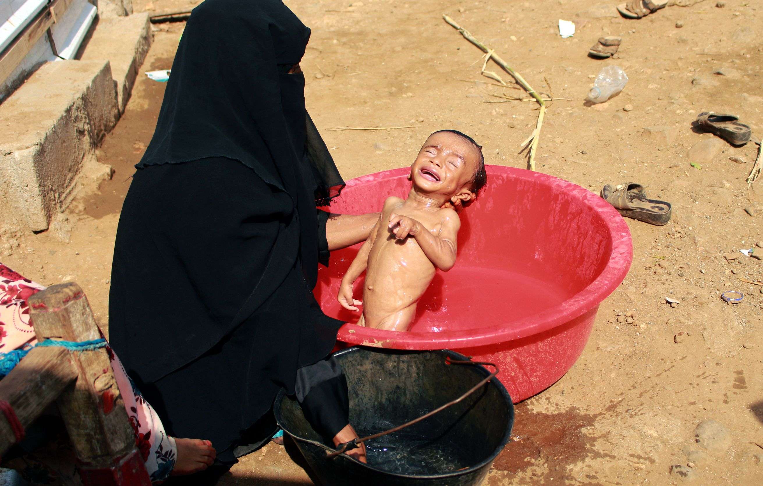 صورة تعكس مدى معاناة اليمنيين بالمناطق الخاضعة لسيطرة الحوثيين