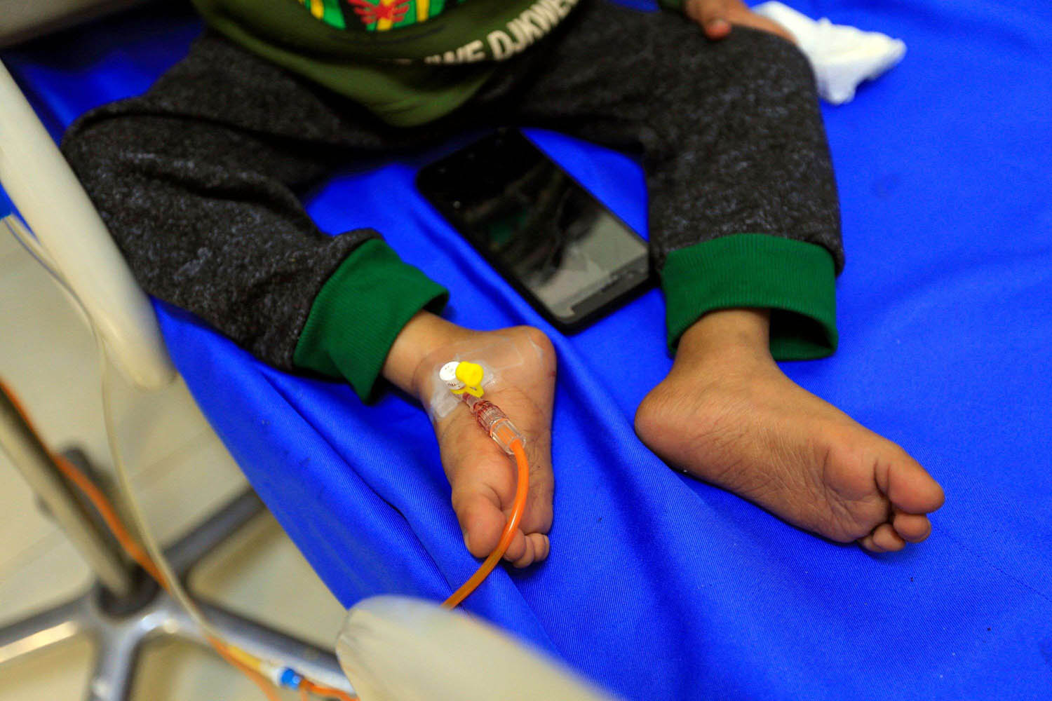 طفل يمني في مستشفى في صنعاء