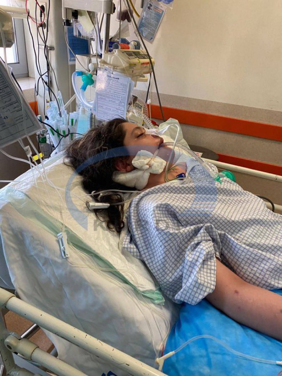 مهسا أميني دخلت في غيبوبة بعد ساعتين فقط من اعتقالها والسلطات تدعي اصابتها بنوبة قلبية ودماغية
