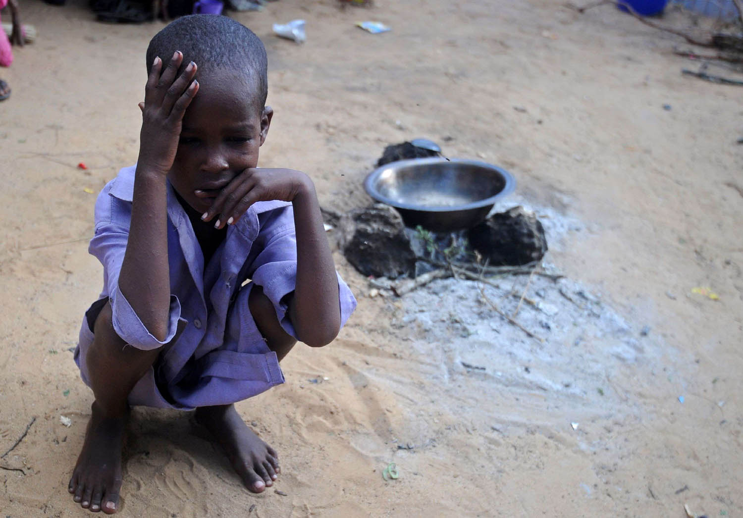 طفل صومالي في معسكر نازحين بسبب المجاعة