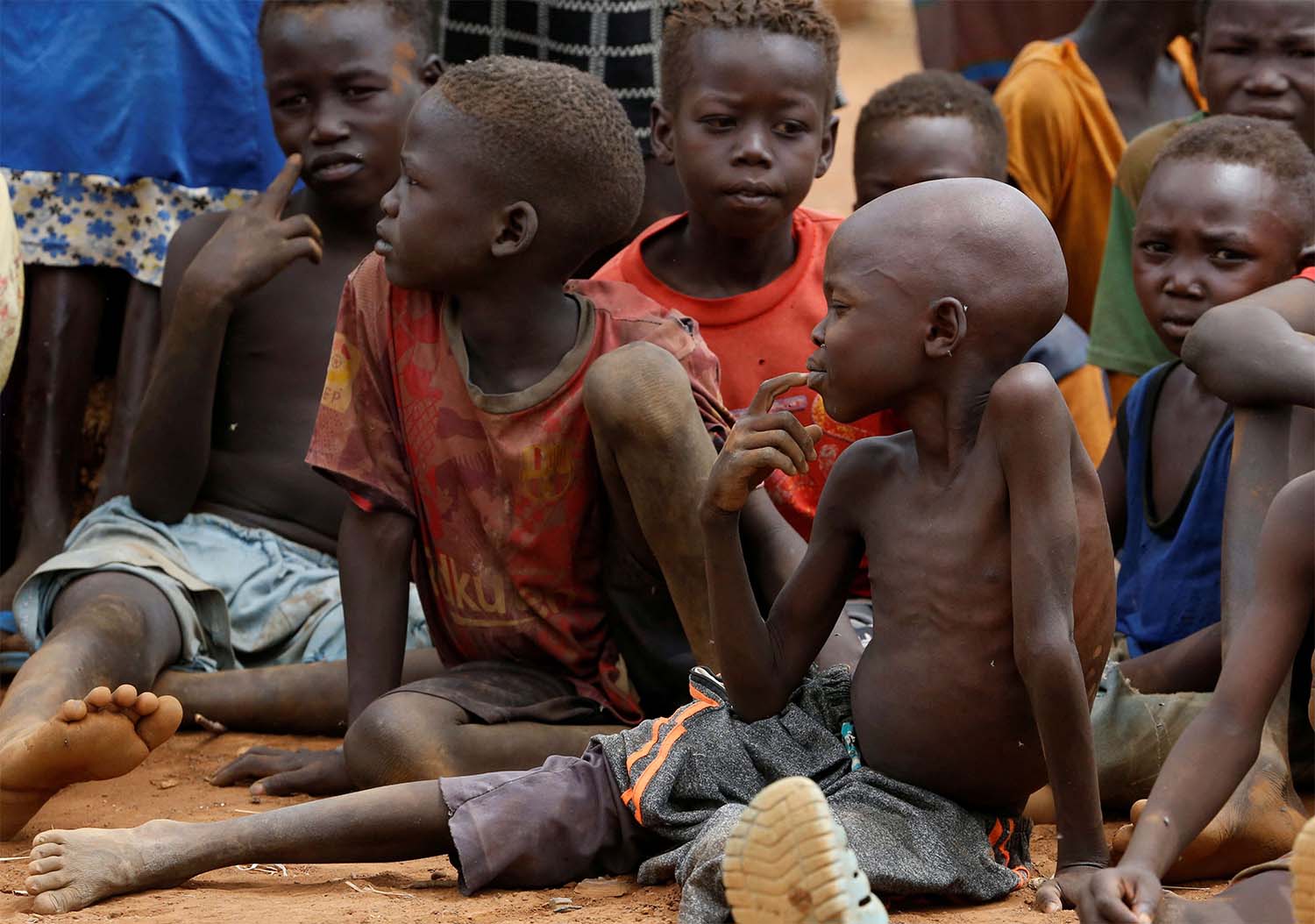 Malnourished kids in Sudan