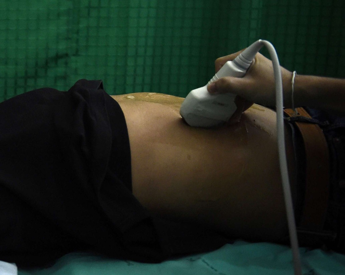 سرطان الكبد