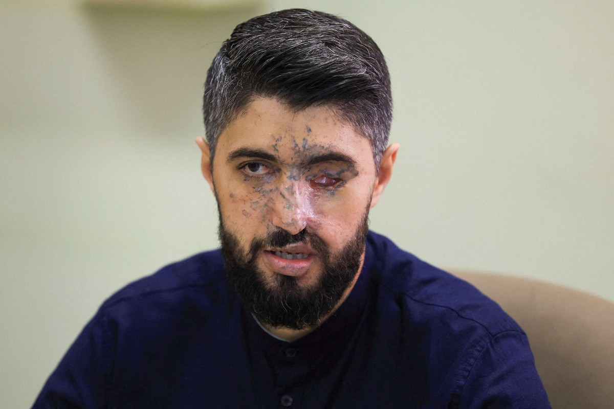 جراح لن تندمل