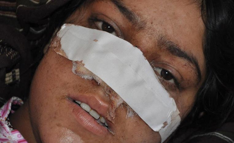 العنف ضد المرأة الافغانية