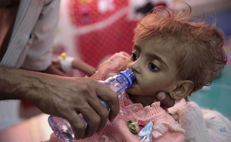 A father gives water to his malnourished daughter at a feeding center in a hospital in Hodeidah