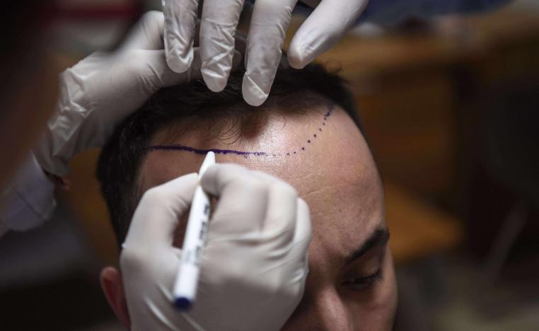 A hair specialist checks a patient in Istanbul