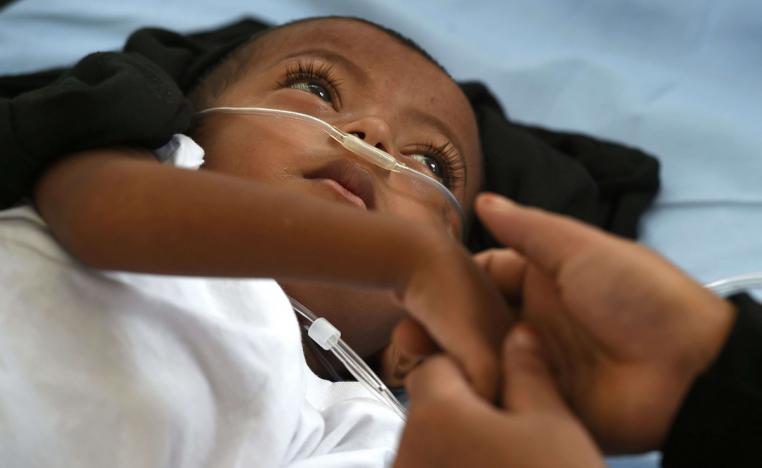 طفل من ميانمار مصاب بالتهاب رئوي