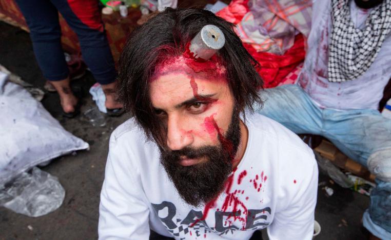An Iraqi actor playing an injured anti-government protester with a tear gas canister lodged in his head