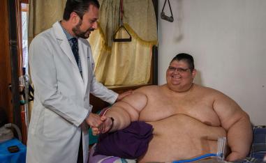 السمنة 