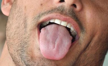 دهون اللسان