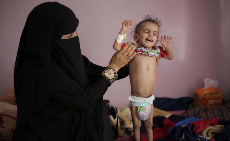 A woman holds her malnourished boy at a feeding center at Al-Sabeen hospital in Sanaa