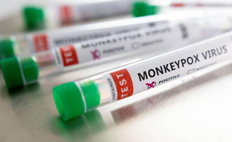 Monkeypox is a usually mild viral infection that is endemic in parts of west and central Africa