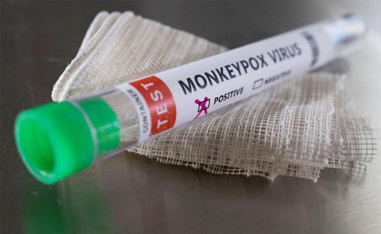 Monkeypox test