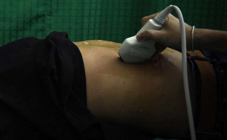 سرطان الكبد