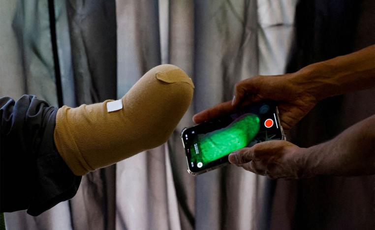 Bioniks hopes to pioneer a large-scale solution for people impacted by the war