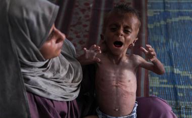 Hidaya, a 31-year-old Palestinian mother, cradles her sick 18-months old son Mohammed al-Mutawaq, who is also displaying signs of malnutrition