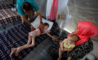 Aid agencies report rapid increase in child malnutrition cases in Gaza