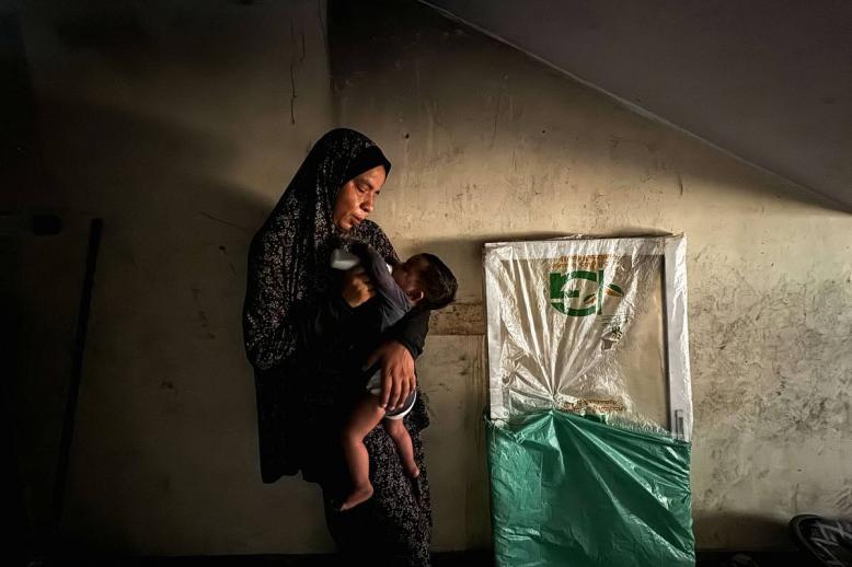 فلسطينية مع طفلها الذي يعاني من نقص التغذية