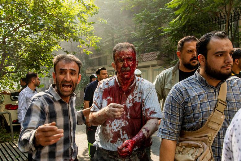 A wounded man reacts following the Israeli strikes on Tehran
