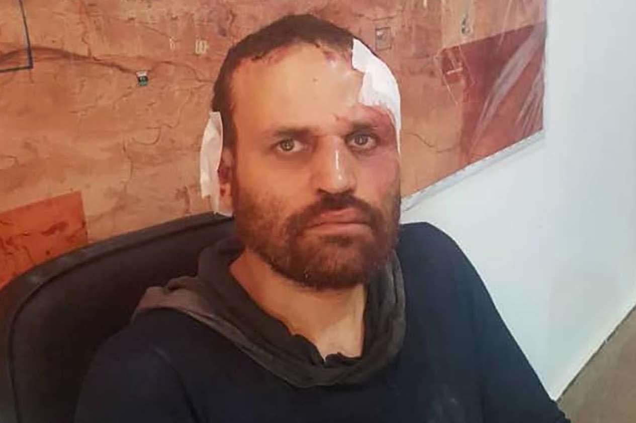 Ashmawy was captured by Haftar's forces in October 2018 in the city of Derna