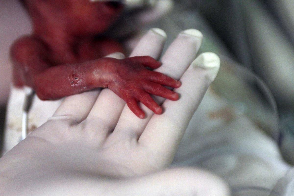 ممرضة تمسك يد طفل ولد مبكرا