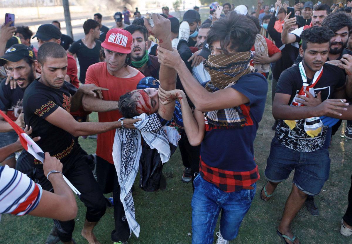 An injured protestor is rushed to the hospital after being shot during a demonstration in Baghdad