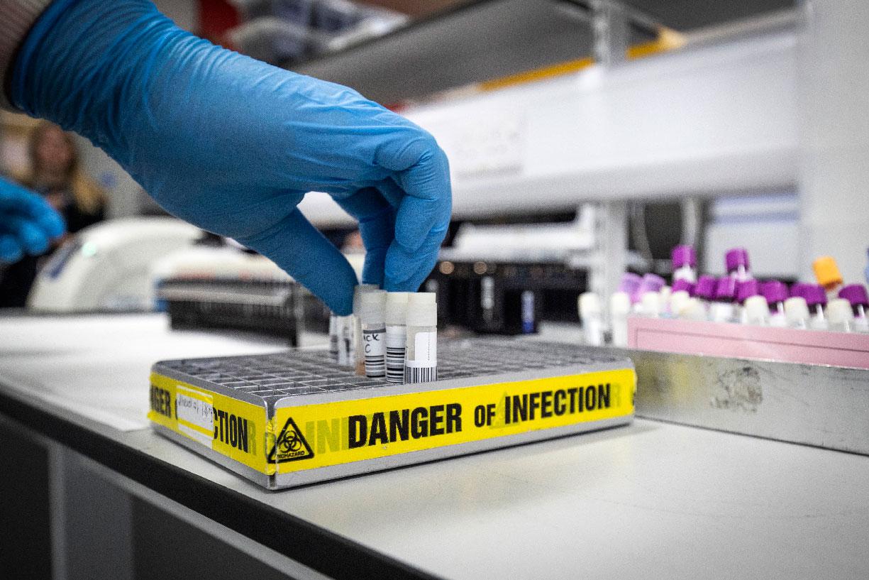 Technician extracts viruses samples at the novel coronavirus testing laboratory at Glasgow Royal Infirmary, Scotland