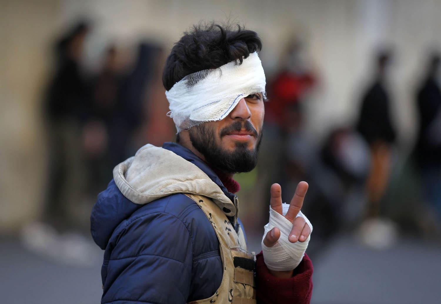 متظاهر عراقي مصاب بعد اعتداء ميليشيا الصدر عليه