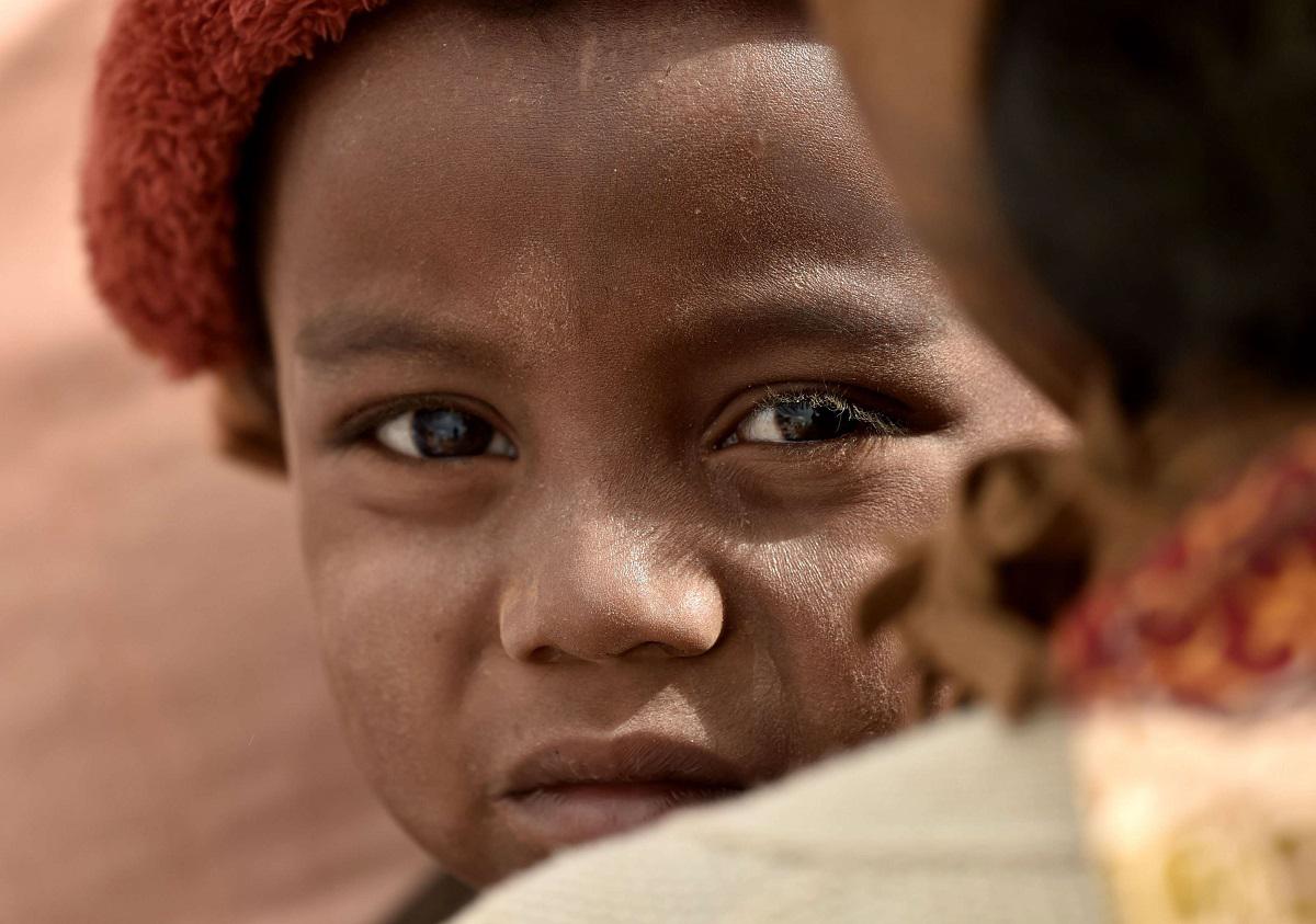 طفل من مدغشقر