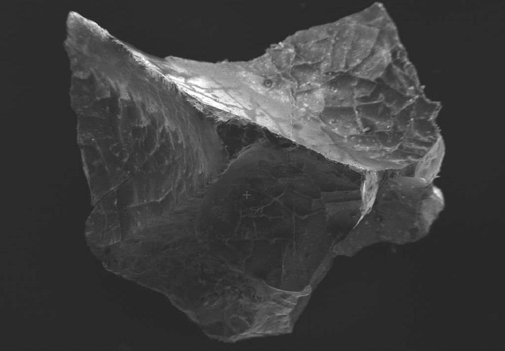 صورة مجهرية لخلايا دماغية لشاب توفي منذ ما يقرب من 2000 عام