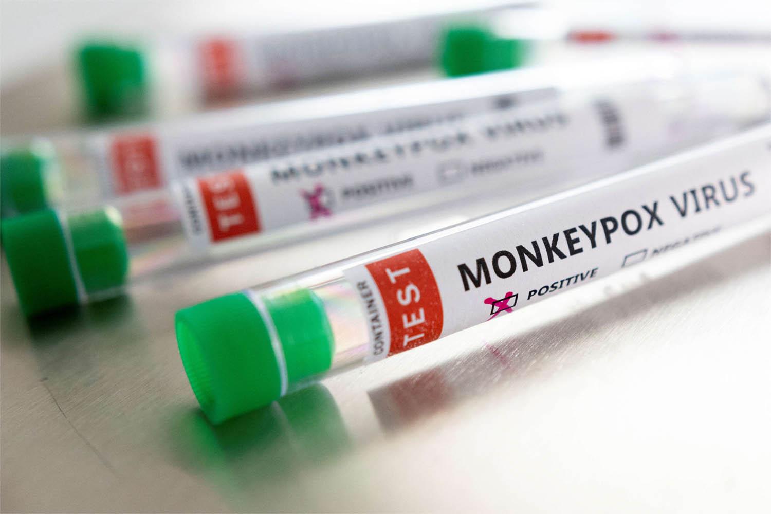 Monkeypox is a usually mild viral infection that is endemic in parts of west and central Africa