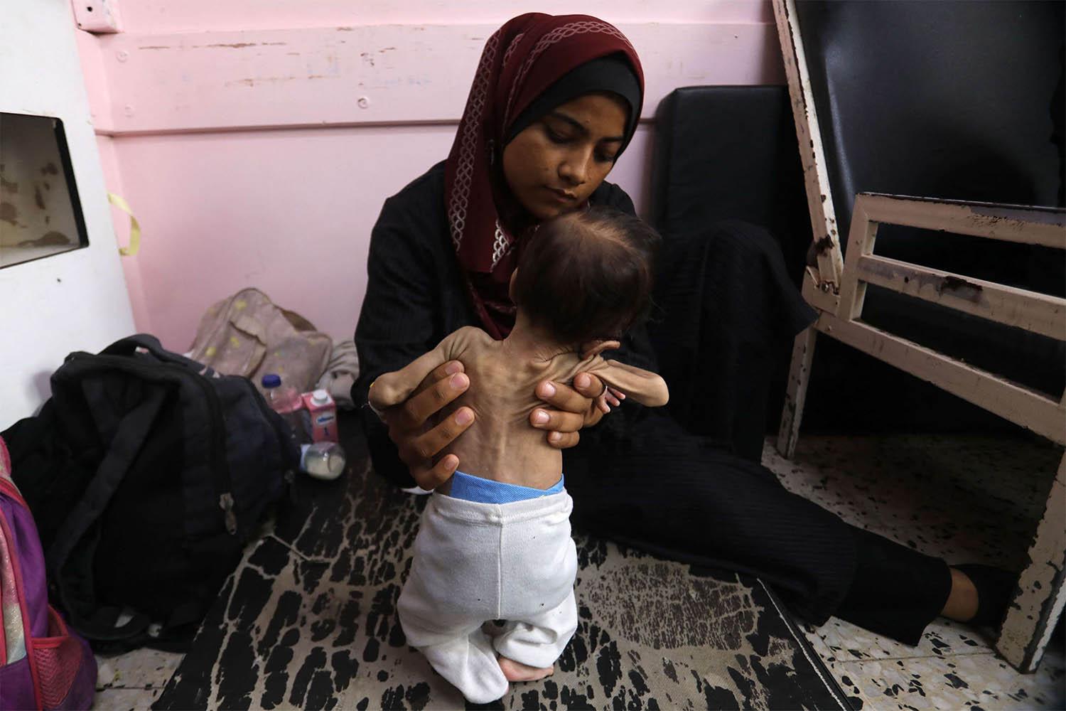 A Palestinian mother holds her malnourished 2-months-old daughter as they await treatment at the Nasser hospital in Khan Yunis