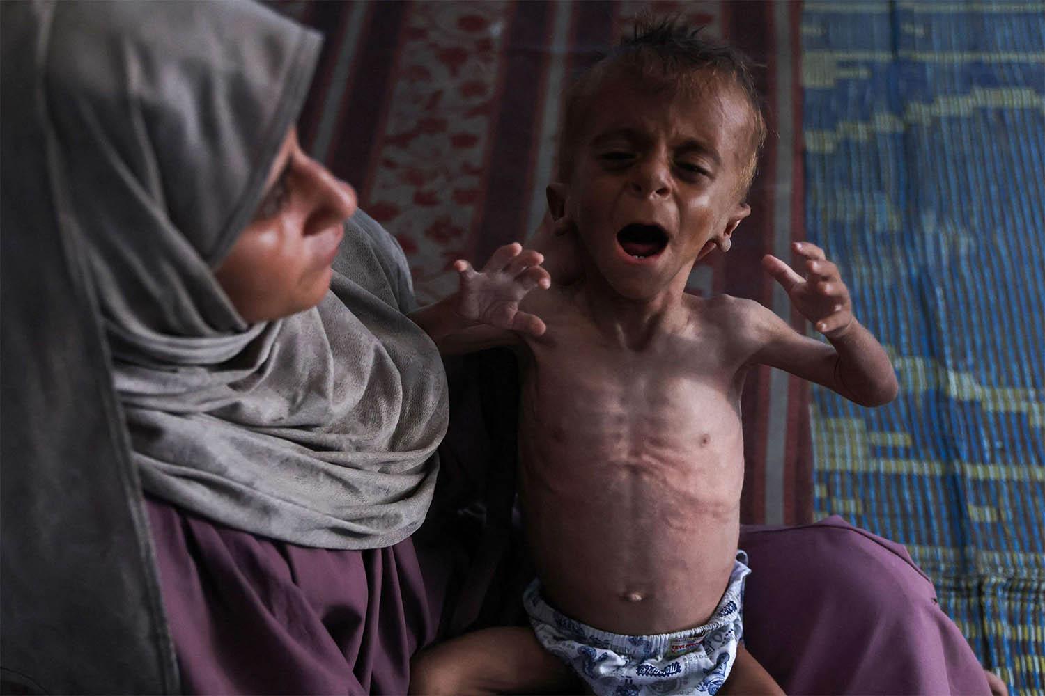 Hidaya, a 31-year-old Palestinian mother, cradles her sick 18-months old son Mohammed al-Mutawaq, who is also displaying signs of malnutrition